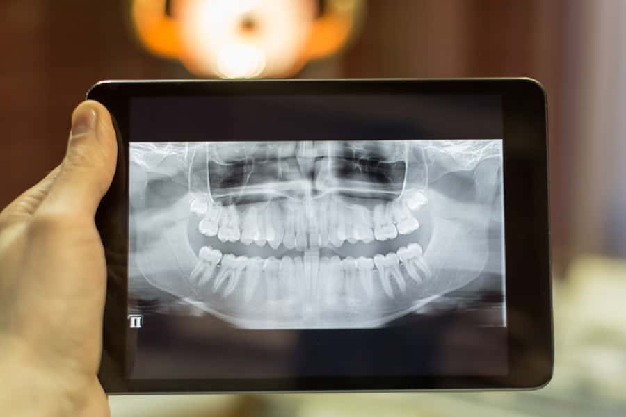 Dental X-Rays in Roselle, IL