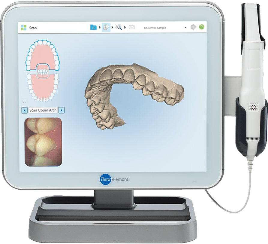 Painless dental impressions with scanner for Invisalign in Roselle, IL. Dental Impressions in Roselle, IL