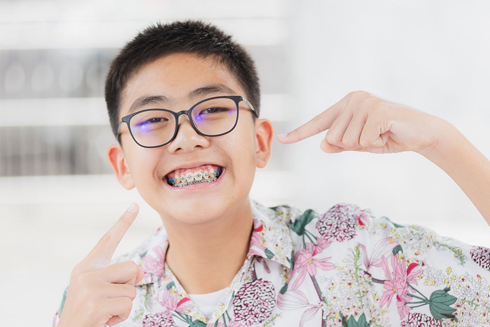 Benefits of Early Orthodontics Treatment