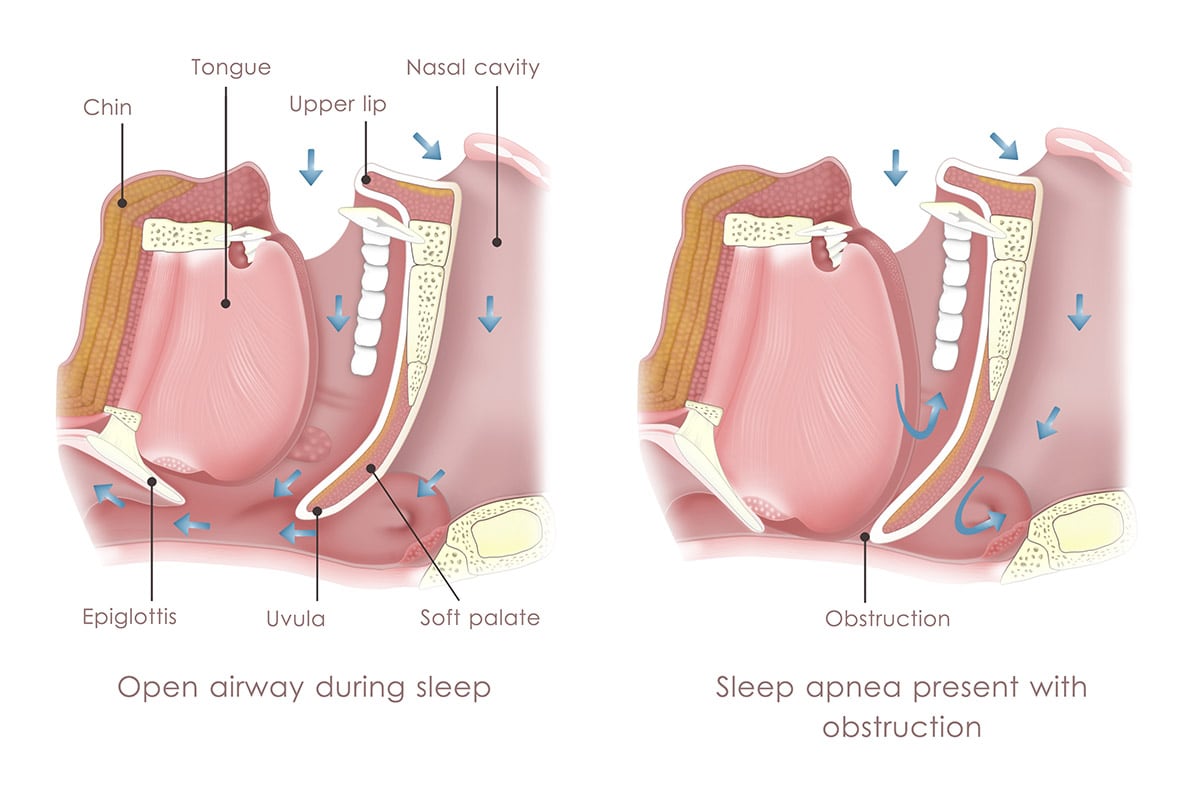 Sleep Technology Dental Treatment